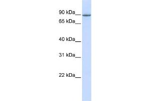 WB Suggested Anti-OTUD7B Antibody Titration:  0. (OTUD7B 抗体  (Middle Region))