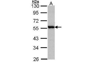WB Image Sample (30 ug of whole cell lysate) A: A431 , 10% SDS PAGE antibody diluted at 1:1000 (DOK3 抗体  (C-Term))