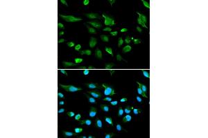 Immunofluorescence analysis of A549 cells using AIRE antibody (ABIN5970888). (AIRE 抗体)