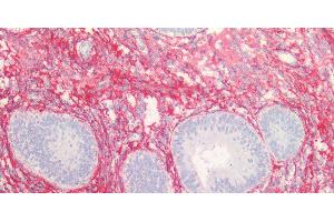 Immunohistochemistry of paraffin-embedded Human endometrium and prostate using COL3A1 Polyclonal Antibody at dilution of 1:100. (COL3A1 抗体)