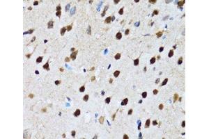 Immunohistochemistry of paraffin-embedded Rat brain using CCAR2 Polyclonal Antibody at dilution of 1:100 (40x lens). (CCAR2 抗体)