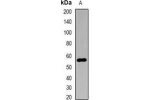 Western blot analysis of Nyctalopin expression in HEK293T (A) whole cell lysates. (Nyctalopin 抗体)