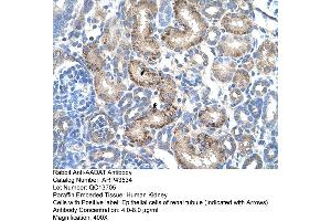 Human kidney (AADAT 抗体  (N-Term))