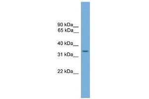 WB Suggested Anti-SLC35A4 Antibody Titration:  0. (SLC35A4 抗体  (Middle Region))
