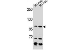 Western blot analysis of Nibrin Antibody (C-term) in NCI-H460, NCI-H292 cell line lysates (35ug/lane). (Nibrin 抗体  (C-Term))