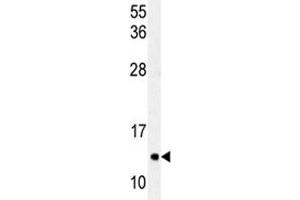 Western blot analysis of LC3C antibody and HeLa lysate (LC3C 抗体  (AA 27-57))