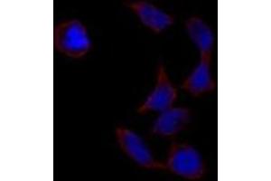 Image no. 2 for anti-POU Class 5 Homeobox 1 (POU5F1) antibody (ABIN357429) (OCT4 抗体)