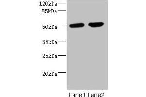 Western blot All lanes: CHRNA10 antibody at 0. (CHRNA1 抗体  (AA 25-240))