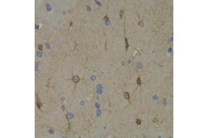 Immunohistochemistry of paraffin-embedded rat brain using WNT3A antibody (ABIN6292349) at dilution of 1:200 (40x lens). (WNT3A 抗体)