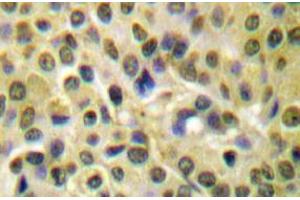 Image no. 1 for anti-V-Akt Murine Thymoma Viral Oncogene Homolog 1 (AKT1) (pSer473) antibody (ABIN317955) (AKT1 抗体  (pSer473))
