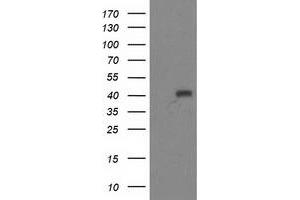 Western Blotting (WB) image for anti-Alcohol Dehydrogenase 1B (Class I), beta Polypeptide (ADH1B) antibody (ABIN1496478) (ADH1B 抗体)