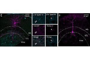 Confocal image stacks of representative Axo-axonic cells (AAC) (E) and Basket Cells (F). (SPTBN4 抗体  (C-Term))