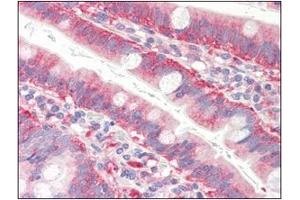 Immunohistochemistry (IHC) image for anti-Cofilin 1 (CFL1) (AA 1-166), (N-Term) antibody (ABIN336102) (Cofilin 抗体  (N-Term))
