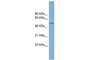 WB Suggested Anti-RNPEPL1 Antibody Titration: 0. (RNPEPL1 抗体  (N-Term))