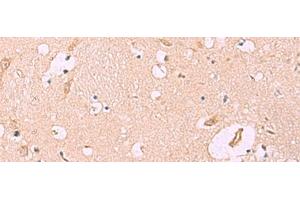 Immunohistochemistry (Paraffin-embedded Sections) (IHC (p)) image for anti-Meckel Syndrome, Type 1 (MKS1) antibody (ABIN7247090)