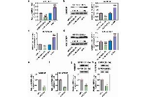MiR-874-3p downregulation eliminated the effects of LINC00922 silencing on GDPD5 in DDP-resistant GC cells, the expression of which was also decreased via transfection. (GDPD5 抗体  (N-Term))