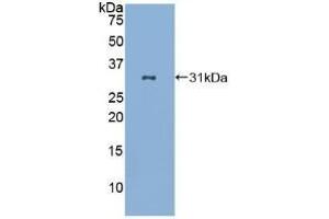 Detection of Recombinant LAB7-2, Human using Polyclonal Antibody to Cluster Of Differentiation 86 (CD86) (CD86 抗体  (AA 46-282))