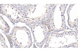 Detection of IGFBP1 in Bovine Testis Tissue using Polyclonal Antibody to Insulin Like Growth Factor Binding Protein 1 (IGFBP1) (IGFBPI 抗体  (AA 112-263))