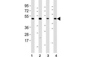 Western blot testing of Mlkl antibody at 1:2000 dilution and mouse samples: (1) lung, (2) NIH3T3, (3) liver, (4) testis lysate; Predicted size: 54 kDa. (MLKL 抗体  (AA 444-472))