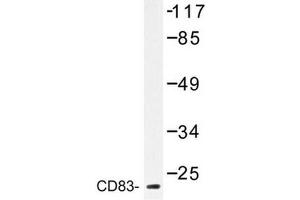 Image no. 1 for anti-CD83 (CD83) antibody (ABIN272283) (CD83 抗体)