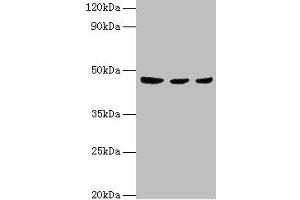 Western blot All lanes: ENTPD5 antibody at 4 μg/mL Lane 1: Mouse liver tissue Lane 2: Mouse kidney tissue Lane 3: Mouse gonad tissue Secondary Goat polyclonal to rabbit IgG at 1/10000 dilution Predicted band size: 48 kDa Observed band size: 48 kDa (ENTPD5 抗体  (AA 149-428))