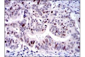 Immunohistochemistry (IHC) image for anti-Kinesin Family Member 22 (KIF22) antibody (ABIN969235)
