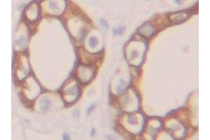 Immunohistochemistry (IHC) image for anti-Keratin 19 (KRT19) (AA 245-391) antibody (ABIN7433303)