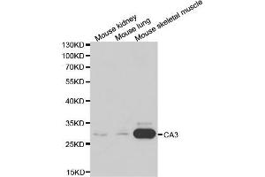 Western blot analysis of extracts of various cell lines, using CA3 antibody (ABIN5970554) at 1/1000 dilution. (CA3 抗体)