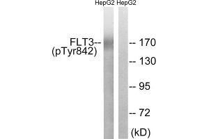 Western blot analysis of extracts from HepG2 cells, treated with EGF (200ng/ml, 30mins), using FLT3 (Phospho-Tyr842)) antibody. (FLT3 抗体  (pTyr842))