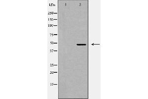 Western blot analysis of GPR103 expression in LOVO cells. (QRFPR 抗体  (Internal Region))