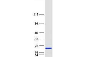 Validation with Western Blot