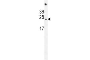 Western Blotting (WB) image for anti-Succinate Dehydrogenase Complex, Subunit D, Integral Membrane Protein (SDHD) antibody (ABIN2996554) (SDHD 抗体)
