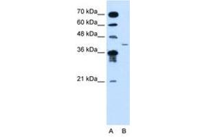 MFAP3L 抗体  (AA 104-153)