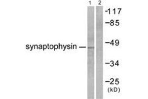Western blot analysis of extracts from LOVO cells, using Synaptophysin Antibody. (Synaptophysin 抗体  (AA 101-150))
