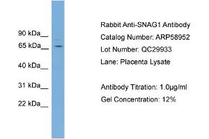 WB Suggested Anti-SNAG1  Antibody Titration: 0. (SNX18 抗体  (C-Term))