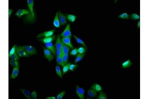 Immunofluorescence staining of Hela cells with ABIN7156446 at 1:200, counter-stained with DAPI. (ITGA6 抗体  (AA 625-866))