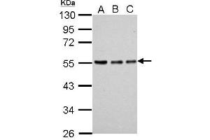 Western Blotting (WB) image for anti-Tubulin, alpha 1a (Tuba1a) antibody (ABIN2856707)