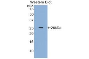 Western Blotting (WB) image for anti-Mucin 17, Cell Surface Associated (MUC17) (AA 3773-3998) antibody (ABIN1078335) (MUC17 抗体  (AA 3773-3998))