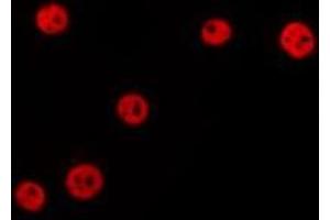 ABIN6277189 staining HepG2 by IF/ICC.