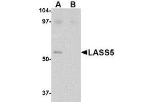 Western blot analysis of LASS5 in SK-N-SH lysate with LASS5 antibody at 1 µg/ml in the (A) absence and (B) presence of blocking peptide. (LASS5 抗体  (C-Term))