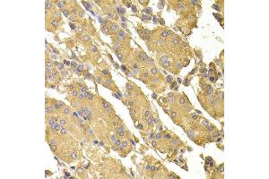 Immunohistochemistry of paraffin-embedded human stomach using PPP2CA antibody. (PPP2CA 抗体  (AA 1-309))