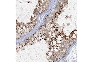Immunohistochemical staining of human testis with ACRBP polyclonal antibody  shows strong cytoplasmic(acrosomal) positivity in cells of seminiferous ducts. (ACRBP 抗体)