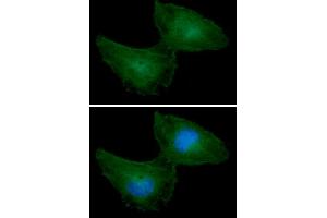 ICC/IF analysis of PRPS1 in HeLa cells line, stained with DAPI (Blue) for nucleus staining and monoclonal anti-human PRPS1 antibody (1:100) with goat anti-mouse IgG-Alexa fluor 488 conjugate (Green). (PRPS1 抗体)