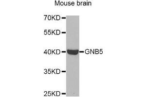 Western Blotting (WB) image for anti-Guanine Nucleotide Binding Protein (G Protein), beta 5 (GNB5) (AA 1-200) antibody (ABIN6220634) (GNB5 抗体  (AA 1-200))