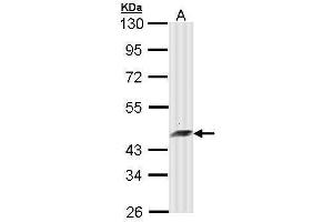 WB Image Sample (30 ug of whole cell lysate) A: Molt-4 , 10% SDS PAGE antibody diluted at 1:10000 (ARFIP2 抗体)