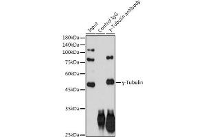 Immunoprecipitation analysis of 300 μg extracts of HeLa cells using 3 μg γ-Tubulin antibody (ABIN7271051). (TUBG1 抗体)