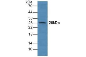 Detection of GSTA4 in Human Lung Tissue using Polyclonal Antibody to Glutathione S Transferase A4 (GSTA4) (GSTA4 抗体  (AA 3-222))