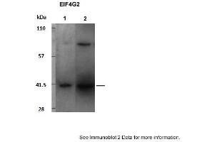 Sample Type: 1. (EIF4G2 抗体  (C-Term))