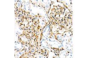 Immunohistochemistry (IHC) image for anti-Vimentin (VIM) antibody (ABIN7271326)