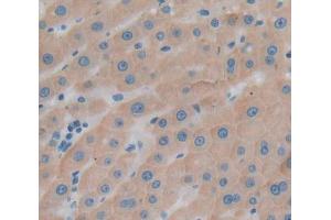 Used in DAB staining on fromalin fixed paraffin- embedded Kidney tissue (UBAP1 抗体  (AA 1-295))
